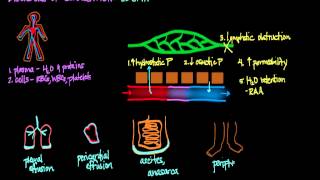 Disorders of Circulation Edema [upl. by Enialahs]