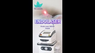 Endolaser face and neck TRIANGEL YASER [upl. by Noissap]