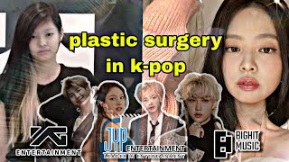 KPOP IDOLS WHO HAS DONE PLASTIC SURGERY 😲🔥💜 kpop idols after plastic surgery 💜🔥 glow up 💖 [upl. by Esinrahs]