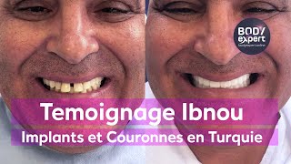 SOINS DENTAIRES  🦷 Témoignage implants et couronnes dentaires  All in 6  BODYEXPERT [upl. by Teferi]