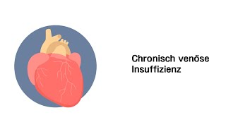 Chronisch venöse Insuffizienz CVI  Erkrankungen der Gefäße und des Kreislauf [upl. by Eckblad]