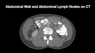 Anatomy of the Abdominal Wall and Abdominal Lymph Node Stations [upl. by On]