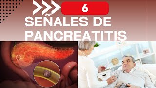 6 señales de que tendrás pancreatitis [upl. by Neidhardt351]