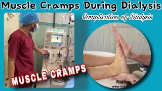 Hemodialysis Complication  Muscle Cramps During Dialysis [upl. by Anbul]