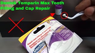 ✅ How To Use Dentek Temparin Max Tooth Filling and Cap Repair Review [upl. by Fuller]