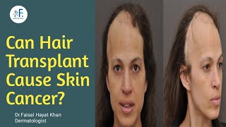 Can Hair Transplant Cause Skin Cancer Dr Faisal Hayat KhanFAesthetics [upl. by Josephina]