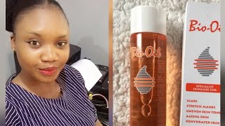 My Experience with Bio Oil Review and how to use for best results [upl. by Mihalco]