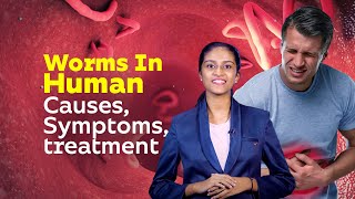 Worms In Human  Causes Symptoms treatment  Healthy Life Style  Worm Diseases [upl. by Nielsen727]