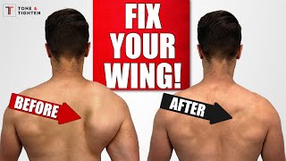 FIX Scapular Winging with Shoulder Blade Exercises [upl. by Annovoj458]