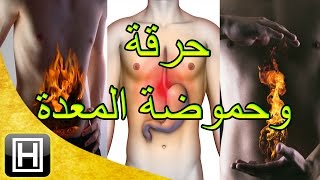 علاج حرقة المعدة والحموضة طبيعيا وبأفضل وأسهل الوصفات [upl. by Ahsirtap]