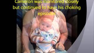 Joubert Syndrome Camerons Story xx [upl. by Enomed]