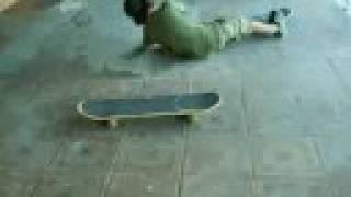 quotelboysquot quebrando o pé no skate [upl. by Yornoc]