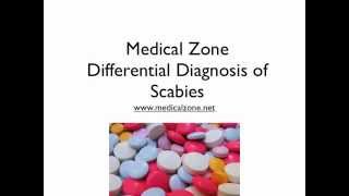 Medical Zone  Differential Diagnosis of Scabies [upl. by Abbot556]