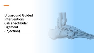 ultrasound Guided Interventions CFL injection fyp sport sports sportsmedicine [upl. by Brunell]