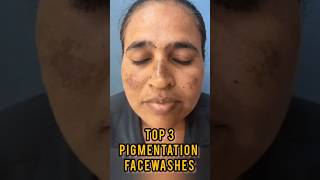 TOP 3 PIGMENTATION FACEWASH teluguvlogs skincare telugubeautytips viral shorts shortsfeed [upl. by Goodard321]