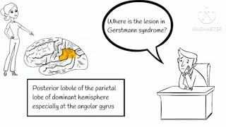 Gerstmann syndrome [upl. by Dadirac278]