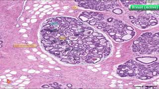 Histology of Breast active  Lactating   Shotgun Histology [upl. by Ydisahc]