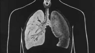 Tuberculosis and How it May be Avoided 1930 Pt 1 of 3 [upl. by Kalam]