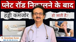 क्या प्लेट या रॉड निकालने के बाद हड्डी कमजोर हो जाती है  Does Removing Plate or Rod Weaken Bone [upl. by Odella825]