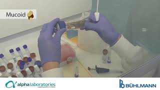 BÜHLMANN CALEX® Cap Sample Collection Demonstration [upl. by Fafa]