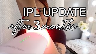 DIY IPL Update after 3 months amp Answering your questions Lescolton IPL [upl. by Schober]