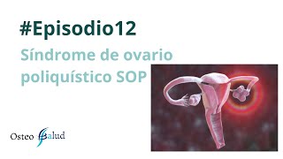 Episodio 12  Síndrome de ovario poliquístico SOP [upl. by Robillard]