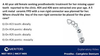 NEET MDS  INICET  Prostho  Fixed Partial Denture  Explanatory Video  MERITERS [upl. by Ailuj]