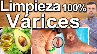 COMO HACER UNA LIMPIEZA DE VARICES 100 [upl. by Kopaz]