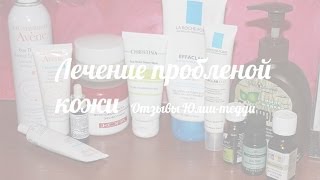 Лечение проблемной кожи Отзывы Юлии тедди [upl. by Mariko768]