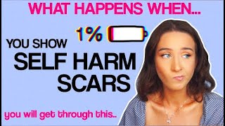 WHAT HAPPENS WHEN YOU SHOW SELF HARM SCARS [upl. by Ardien]