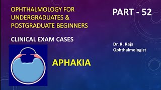 52  APHAKIA Disadvantages of Aphakic Spectacles  by Dr R Raja see description [upl. by Eisned]