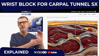 Wrist Block For Carpal Tunnel Sx  Crash course with Dr Hadzic [upl. by Odraude]