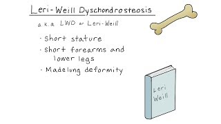 LeriWeill dyschondrosteosis [upl. by Catina]