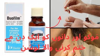 Remove mols and warts and acne remove solution within one Lotion 🧴  Duofilm Lotion [upl. by Dag]