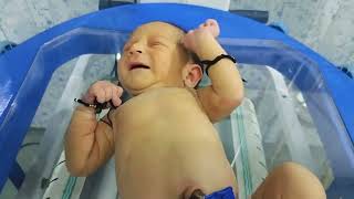 NICU में baby को phototherapy क्यों लगाते हैं [upl. by Atnohsal]