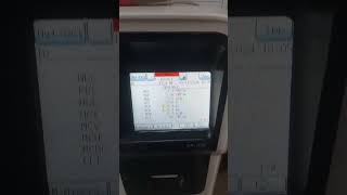 How To Print Your CBC Result in Sysmex Xp 100 sysmex hematologyanalyzer shorts [upl. by Idrahs]