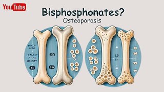 【Bisphosphonates】Pharmacology  Mechanism of Action Simply Explained [upl. by Yednarb813]