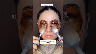 Remove Dark Circles Naturally At Home In 1DayUnderEye Dark Circles Remove Homeremedy dark shorts [upl. by Darrow]