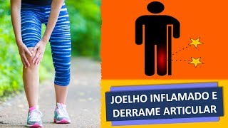 JOELHO INFLAMADO E DERRAME ARTICULAR [upl. by Richardo]