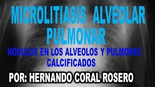 MICROLITIASIS ALVEOLAR PULMONAR  NÓDULOS EN LOS ALVEOLOS Y PULMONES CALCIFICADOS [upl. by Aven954]