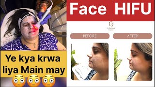 Face HIFU Treatment krwya  Shadi pay jane ke Taiyari end hoi  Sweejackvlogs [upl. by Hpesoj]