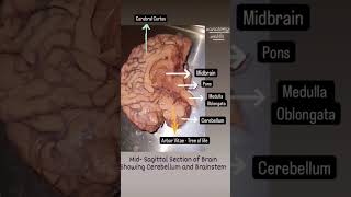 MidSagittal Section of Brain showing Cerebellum and Brainstem shorts mbbs anatomy neet brain [upl. by Collar128]