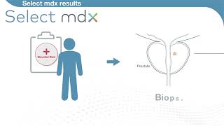 Select mdx for Prostate Cancer [upl. by Spearing]