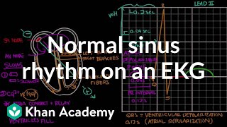 Normal sinus rhythm on an EKG  Circulatory System and Disease  NCLEXRN  Khan Academy [upl. by Eenahc867]