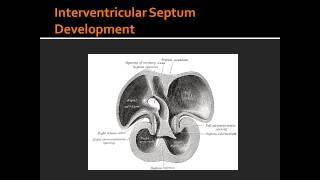 Interventricular Septum Development [upl. by Grunenwald]