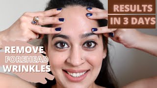 Forehead Massage To Reduce Wrinkles  Facial Yoga  FAST RESULTS  Sonali Beauty [upl. by Olaznog]