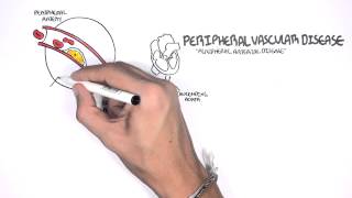 Cardiovascular Disease Overview [upl. by Retsbew]