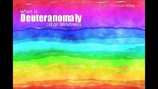 Deuteranomaly Color Blindness [upl. by Morganstein]