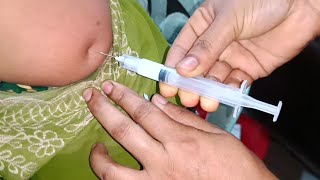 Arm injection IM Soma Ject Injection Push √√ Injection Video জন্মবিরতিকরণ ইনজেকশন 24 Ep 53 [upl. by Welker]