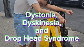 Dystonia Dyskinesia and Drop Head Syndrome [upl. by Il585]